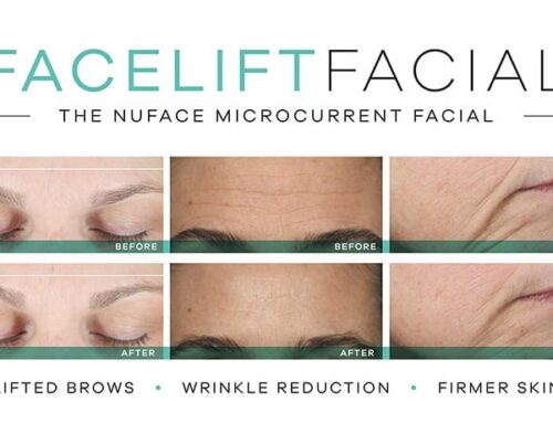 The Nuface Facelift is here!